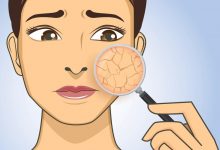 قناع الشاي والينسون .. للمحافظة على نضارة بشرتك